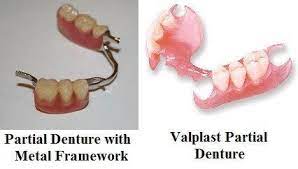 The clasps can be made of either clear plastic, pink plastic, or metal (wironium®). The Difference In Metal Vs Valplast Partial Dentures Ja Denture Clinic