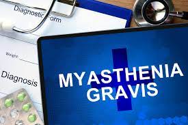 Patients With Als And Myasthenia Gravis Prompt Search For Shared Links