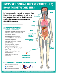 Cancer in the bone may cause severe pain for a while before the bone breaks. P R O G N O S I S F O R M E T A S T A T I C B R E A S T C A N C E R Zonealarm Results