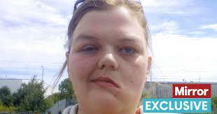 People think I look like a monster, but I just want…