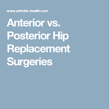 Anterior Vs Posterior Hip Replacement Surgeries Hip Replacement Hip Replacement Exercises Hip Replacement Recovery