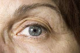 Have The Dry Eyes Of Menopause Health Beat Spectrum Health