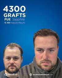 Tecnifue International