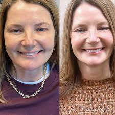 Wake Up with Your Dream Smile at Cosmetic & Advanced Dentistry