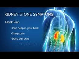 What It S Like To Get A Kidney Stone Ultrasound Youtube