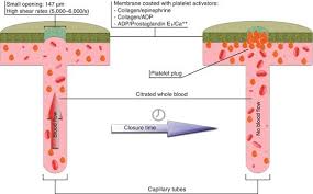 Image result for Platelet Function Closure Time