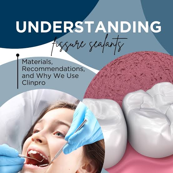 Understanding Fissure Sealants For Teeth: Benefits and FAQs