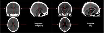 Image result for CT Head