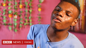 Àwọn ilé ẹ̀kọ́ lé mi dànù pé wọn ò lè gbà mí torí pé bí àwọn òbí akẹ́kọ̀ọ́  tókù yóò ṣe sọ̀rọ̀