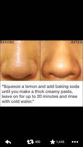 How To Get Rid Of Black Spots On Your Nose Exposed Skin Care Skin Care Treatments Beauty Skin Care