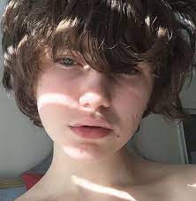 Anyone Know How He Got That Scar Jet Hair Short Hair Styles Types Of Hair Color