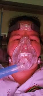 Did anyone get pneumonia after surgery?