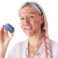 Renee Peel's Instagram, Twitter & Facebook