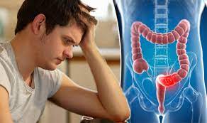 Bowel cancer is the third leading cause of cancer in the u.s. Bowel Cancer Risk Would You Report These Symptoms Of The Disease Express Co Uk