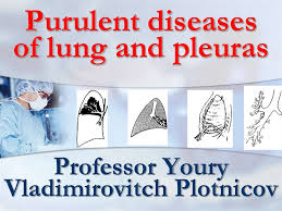 Pus01en Online Presentation