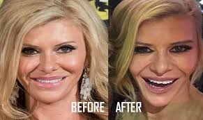 Does anyone else watch Melbourne and what are your favourite moments? So  underrated IMO. : r/realhousewives