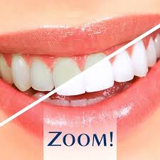 Zoom is a bleaching process widely used throughout the country and around the world to lighten discoloration of enamel and dentin. Zoom Teeth Whitening Jo Home Facebook