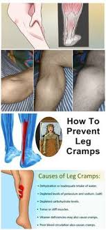 Leg Cramps Leg Cramps Leg Cramps At Night Leg Cramps Causes