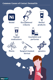 Contact Dermatitis: Causes And Risk Factors