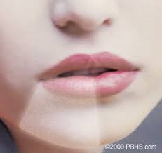 Will it affect me to say something i shouldn't say or something else? After Extraction Of Wisdom Teeth Richmond Va Dry Socket Infection Tuckahoe Bon Air Mechanicsville