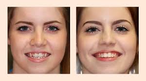 Oak Park Dentist Patient Testimonials-Dr. James Scapillato