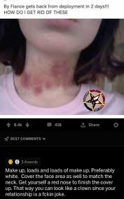 Here in this video i talkabout how to hide a hickey without makeup I Need To Cover Up My Hickies Before My Husband Gets Home Justdependathings