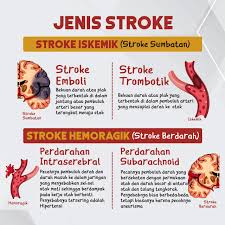 Check spelling or type a new query. Rs Keluarga Sehat En Twitter Salam Keluarga Sehat Penyakit Stroke Adalah Penyakit Yang Terjadi Ketika Pasokan Darah Menuju Otak Terganggu Atau Sama Sekali Berkurang Sehingga Jaringan Otak Kekurangan Oksigen Dan Nutrisi Manfaatkan