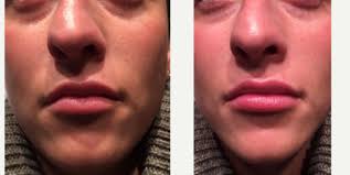 Columbus Facial Plastics