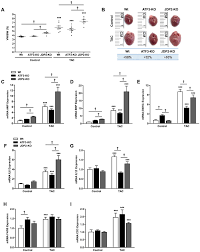 Certaines maladies affectant l'appareil respiratoire, telles que les allergies ou la bronchite, conduisent à des problèmes de respiration désagréables et empêchent les. C Jun Dimerization Protein 2 Jdp2 Deficiency Promotes Cardiac Hypertrophy And Dysfunction In Response To Pressure Overload International Journal Of Cardiology