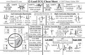 12 Lead Ekg Mi Interpretation Mnemonics Put Mouse Over Cheat Sheet Card Or T Shirt To See The Back Icu Nursing Nursing Jobs Ekg