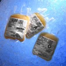 Your red blood cells, white blood cells, and platelets are all returned back to your body. Plasma Nhs Blood Donation