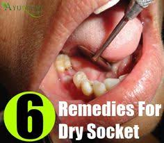 We did not find results for: 9 Ear Ache Remedy Ideas Remedies Ear Ache Home Remedies