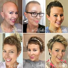 Being very thin, it may also not be visible from however, hair texture might be different to how it was before. Pin On Hair Regrowth