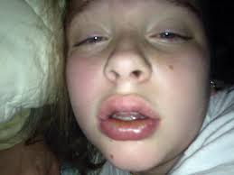 Fundraiser for Melissa Locklear by Ann Faircloth : Helping the Locklear  Family