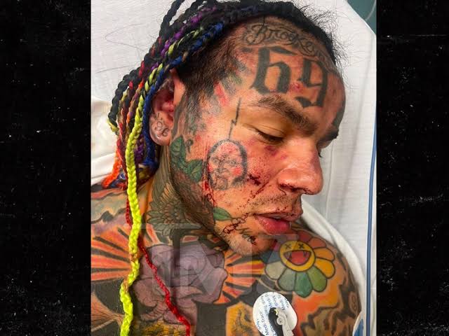 Rapper Tekashi 6ix9ine caiu em uma emboscada e foi parar no hospital