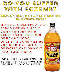 Eczema And Apple Cider Vinegar Organic Apple Cider Vinegar Apple Cider Vinegar Apple Cider Benefits