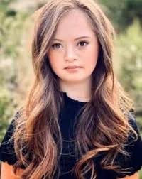 Challenging beauty standards with a model with Down syndrome