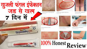 Rx Review Medicine Review Drmomet Oc Skin Cream Review à¤ à¤à¤² à¤« à¤à¤² à¤à¤¨ à¤« à¤ à¤¶à¤¨ à¤ à¤ à¤° à¤® Uses Benefits When using hints, in some cases, you might need to specify a full set of hints in order to ensure the optimal execution plan. drmomet oc skin cream review