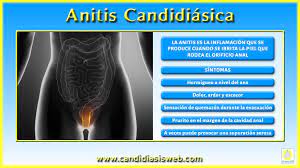 Candidiasis Mucocutaneas Anitis Candidiasica