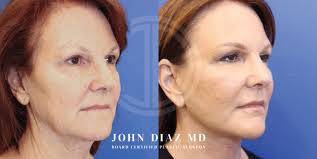 Beverly Hills Plastic Surgeon