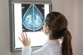 The study determined that the sweet spot for finding breast cancer is in the recall range of 12 to 14 percent, compared to the current guidelines of 5 to 12 percent. Understanding The Aggressive Breast Cancers Missed By Mammogram Screening Ohsu News