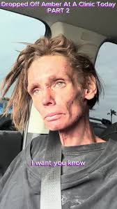 Amber in Hospital Kensington 2024