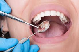 Image result for Tooth Extraction