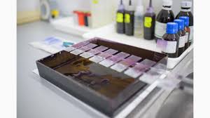 Definiie proteina c reactiv este o protein seric produs de ficat care apare n snge n faza acut a inflamaiilor (protein de faz acut). Psa Total Cantitativ Elfa ProvidenÈa PoliclinicÄ Èi Spital