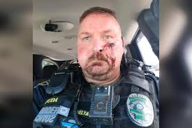 Police chief stabbed in face with ice pick after answering door