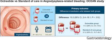 Image result for Octreotide