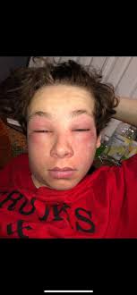 Contributions to the tribute of Nate Condie