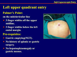 This site is chosen in patients with previous midline laparotomy, pelvic pathology that extends to or above the umbilicus, very thin patients, very obese patients, or after multiple failed attempts. Safe Entry In Laparoscopy Ppt Video Online Download