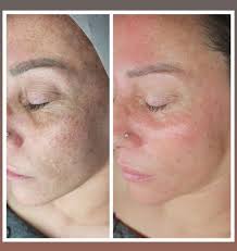 Профил за Belleza Y Salud Verónica Mateos