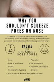 Is It Bad To Squeeze Pores On Nose You Need To Stop
